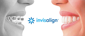 Zertifizierung Invisalign